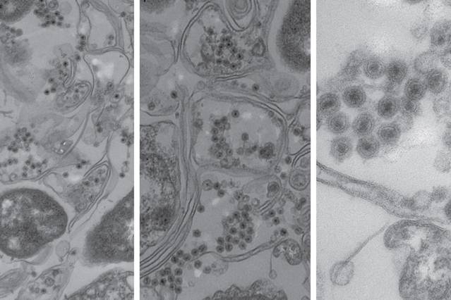 Electron microscope images of marine bacteria infected with the non-tailed viruses studied in this research. The bacterial cell walls are seen as long double lines, and the viruses are the small round objects with dark centers. (Courtesy of researchers)